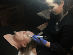 Pelleve' Treatment - Enza MediSpa